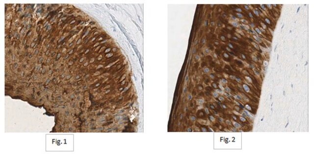 Anti-Keratin K3/K76 Antibody, clone AE5 clone AE5, from mouse