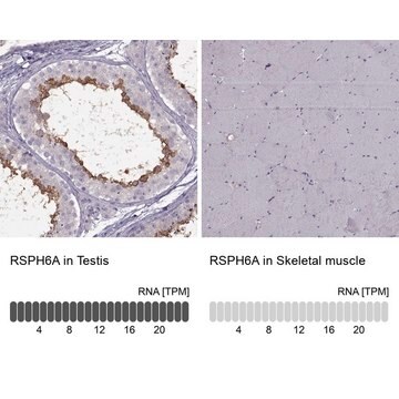 Anti-RSPH6A antibody produced in rabbit Prestige Antibodies&#174; Powered by Atlas Antibodies, affinity isolated antibody, buffered aqueous glycerol solution