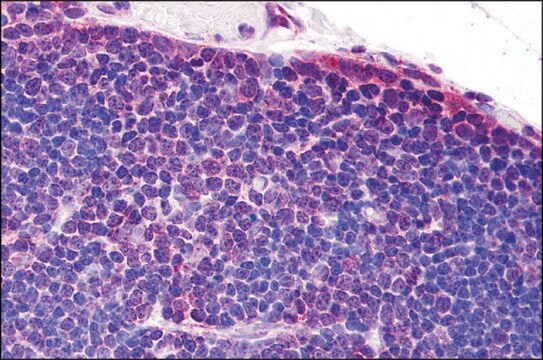 抗TLR8抗体 ウサギ宿主抗体 affinity isolated antibody