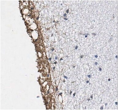 Anticorps anti-peptidyl-citrulline, clone F95 clone F95, from mouse