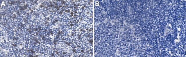 Anti-CD8a Antibody, clone 1J4 ZooMAb&#174; Rabbit Monoclonal recombinant, expressed in HEK 293 cells