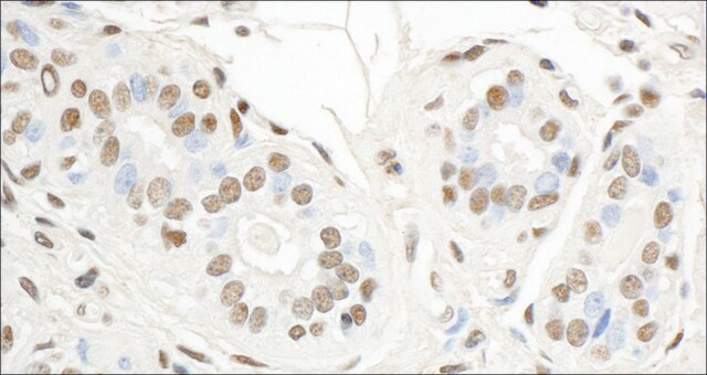 Rabbit anti-Sp1 Antibody, Affinity Purified Powered by Bethyl Laboratories, Inc.