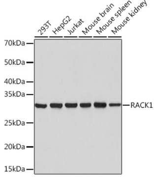 Anti-RACK1 Antibody, clone 7B6J4, Rabbit Monoclonal