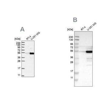 Anti-PDLIM7 antibody produced in rabbit Prestige Antibodies&#174; Powered by Atlas Antibodies, affinity isolated antibody