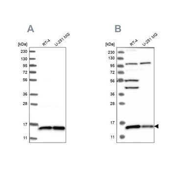 Anti-FAM136A antibody produced in rabbit Prestige Antibodies&#174; Powered by Atlas Antibodies, affinity isolated antibody, buffered aqueous glycerol solution, ab2