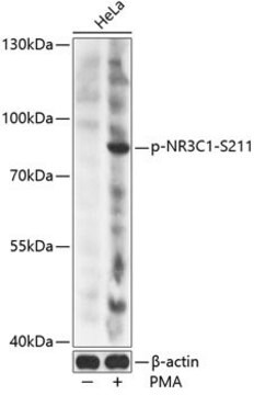 Anti-Phospho-NR3C1-S211 antibody produced in rabbit