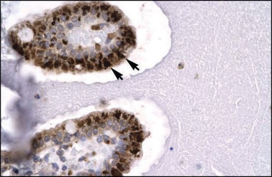 抗SIRT5抗体 ウサギ宿主抗体 affinity isolated antibody