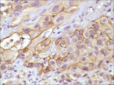 Anti-Mesothelin antibody, Rabbit monoclonal clone SP74, recombinant, expressed in proprietary host, affinity isolated antibody