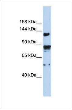 Anti-TRPM4 antibody produced in rabbit affinity isolated antibody