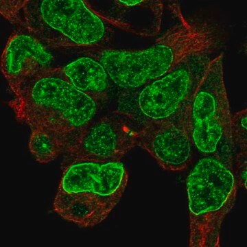 Anti-CPD Prestige Antibodies&#174; Powered by Atlas Antibodies, affinity isolated antibody