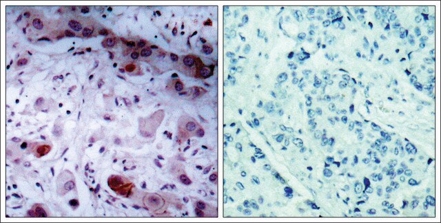 抗 磷酸-JAK1 (pTyr 1022 ) 兔抗 affinity isolated antibody