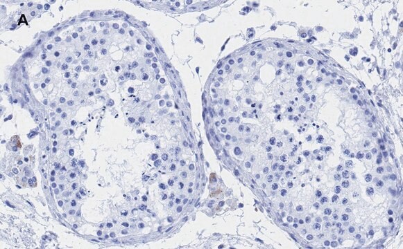 抗アンドロゲン受容体抗体 クローン3K11 ZooMAb&#174; ウサギ・モノクローナル recombinant, expressed in HEK 293 cells