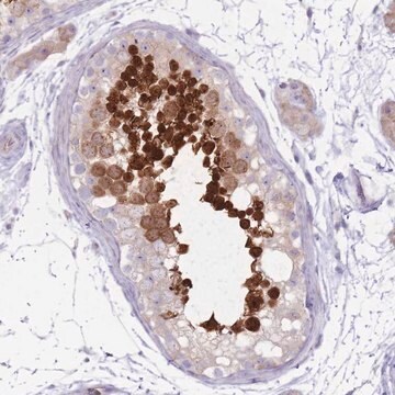 Anti-RPL18 antibody produced in rabbit Prestige Antibodies&#174; Powered by Atlas Antibodies, affinity isolated antibody, buffered aqueous glycerol solution