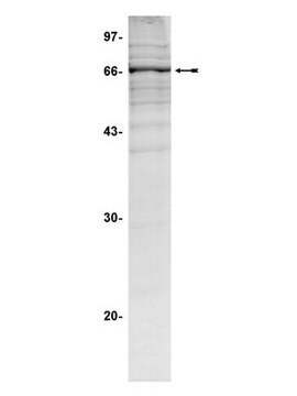 Białko ROKα/ROCK-II, aktywne, szczur, 10 µg Active, rat, N-terminal, His-tagged, fusion protein corresponding to amino acids 2-543 of rat ROKa/ROCK-II. For use in Kinase Assays.