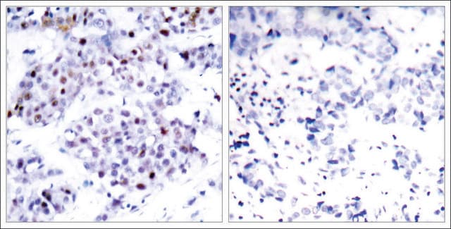 Anti-STAT6 (Ab-645) antibody produced in rabbit affinity isolated antibody