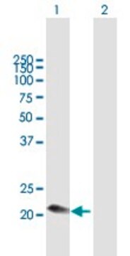 Anti-C1QC antibody produced in mouse purified immunoglobulin, buffered aqueous solution