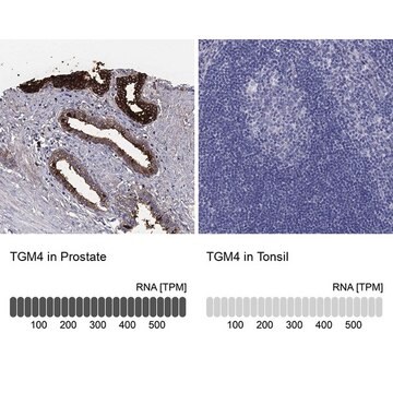 Anti-TGM4 antibody produced in rabbit Prestige Antibodies&#174; Powered by Atlas Antibodies, affinity isolated antibody, buffered aqueous glycerol solution