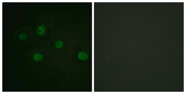 Anti-DNA-PK antibody produced in rabbit affinity isolated antibody