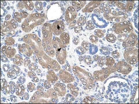 Anti-ST3GAL5 antibody produced in rabbit IgG fraction of antiserum