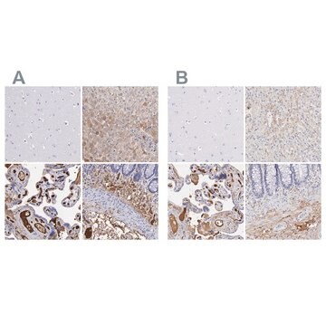 抗FGB ウサギ宿主抗体 Ab1, Prestige Antibodies&#174; Powered by Atlas Antibodies, affinity isolated antibody, buffered aqueous glycerol solution