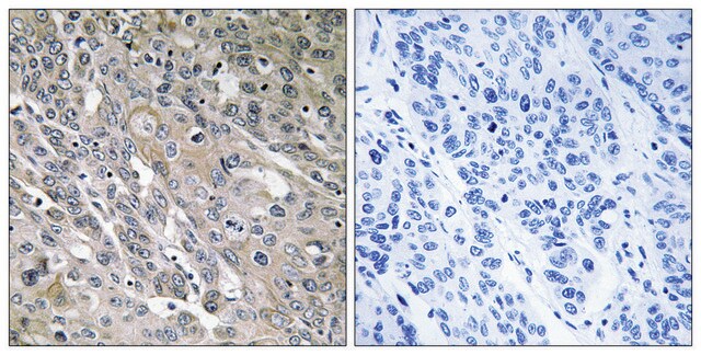 Anti-ARHGEF9 antibody produced in rabbit affinity isolated antibody