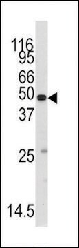 ANTI-METHIONYL TRNA SYNTHETASE(C-TERMINAL) antibody produced in rabbit purified immunoglobulin, buffered aqueous solution