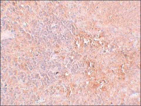 Anti-JMJD4 antibody produced in rabbit affinity isolated antibody, buffered aqueous solution