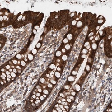 Anti-RIOK3 antibody produced in rabbit Prestige Antibodies&#174; Powered by Atlas Antibodies, affinity isolated antibody, buffered aqueous glycerol solution