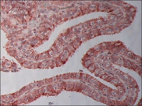 Przeciwciało przeciw beta-tubulinie I, mysie monoklonalne clone SAP.4G5, purified from hybridoma cell culture