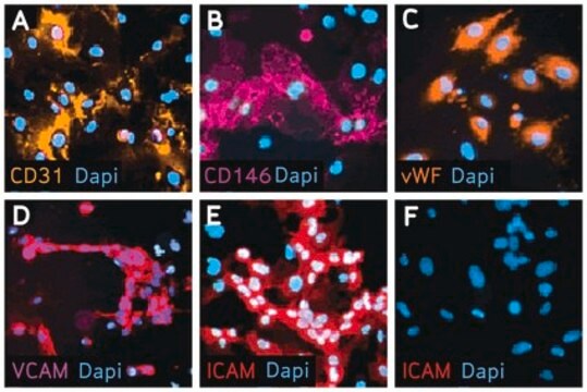 Kit zur Charakterisierung von Endothelzellen Endothelial cell characterization kits enable researchers to characterize cultured endothelial cells in both a constitutive &amp; activated state using basic ICC techniques.