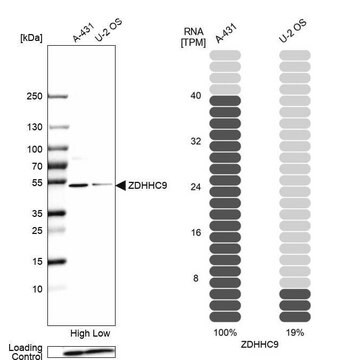 Anti-ZDHHC9 antibody produced in rabbit Prestige Antibodies&#174; Powered by Atlas Antibodies, affinity isolated antibody, buffered aqueous glycerol solution