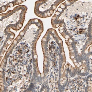 抗SFXN3抗体 ウサギ宿主抗体 Prestige Antibodies&#174; Powered by Atlas Antibodies, affinity isolated antibody, buffered aqueous glycerol solution