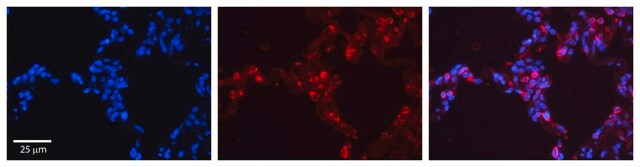 抗SFTPB抗体 ウサギ宿主抗体 affinity isolated antibody