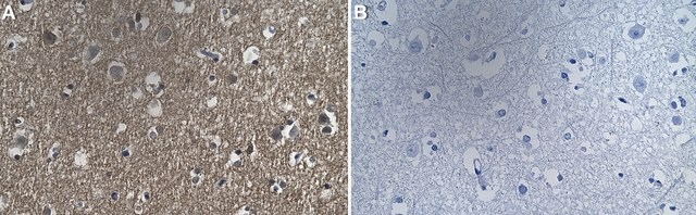 Anti-Cav3.2 Antibody, clone 1D17 ZooMAb&#174; Rabbit Monoclonal recombinant, expressed in HEK 293 cells