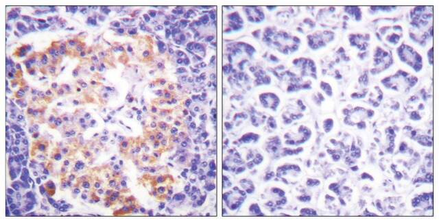 抗胶原蛋白III 兔抗 affinity isolated antibody