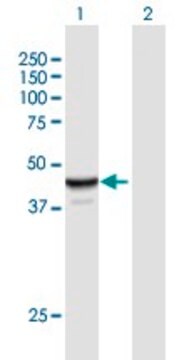 Anti-NAPRT1 antibody produced in mouse IgG fraction of antiserum, buffered aqueous solution