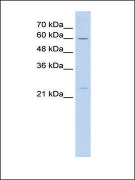 Anti-GINS1 IgG fraction of antiserum