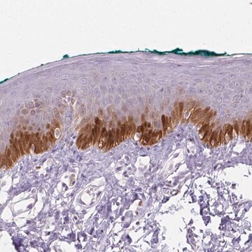 Anti-TMEM45A antibody produced in rabbit Prestige Antibodies&#174; Powered by Atlas Antibodies, affinity isolated antibody, buffered aqueous glycerol solution