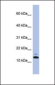 Anti-ASAH1, (N-terminal) antibody produced in rabbit affinity isolated antibody