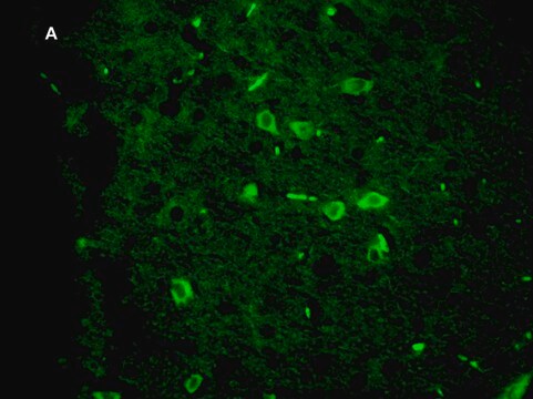 抗緑色蛍光タンパク質 (GFP) 抗体 クローン4I10 ZooMAb&#174;ウサギモノクローナル recombinant, expressed in HEK 293 cells