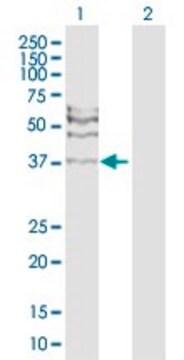 Anti-RAD51C antibody produced in rabbit purified immunoglobulin, buffered aqueous solution