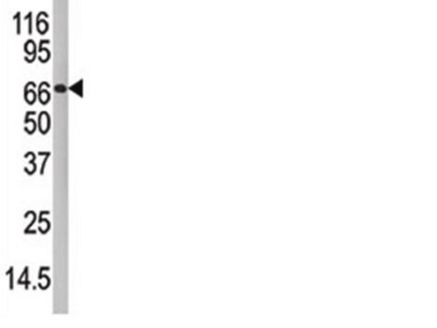 Anti-PADI4 Antibody, CT from rabbit