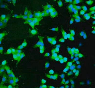 BioTracker胱氨酸-FITC活细胞染料 Live cell imaging dye that measures cystine uptake at the single cell level used to detect glutathione (GSH) synthesis, reactive oxygen species (ROS) detoxification, T-cell activation and B-cell development.