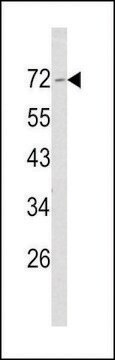 ANTI-MERLIN(N-TERMINAL) antibody produced in rabbit purified immunoglobulin, buffered aqueous solution