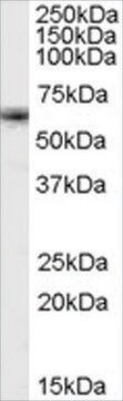 抗FOXO4/MLLT7抗体 ヤギ宿主抗体 affinity isolated antibody, buffered aqueous solution