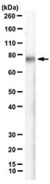 Anti-Desmoglein-2 Antibody, clone CSTEM28