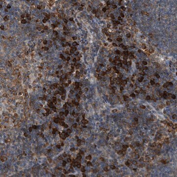 Anti-SEMA4D antibody produced in rabbit Prestige Antibodies&#174; Powered by Atlas Antibodies, affinity isolated antibody, buffered aqueous glycerol solution