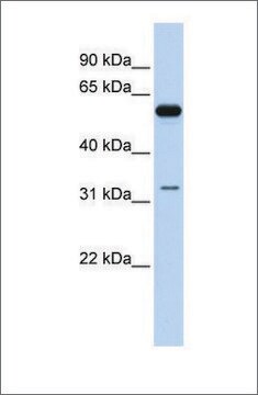 抗DDX28抗体 ウサギ宿主抗体 affinity isolated antibody