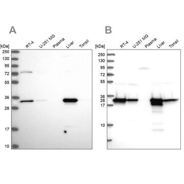 抗HADH抗体 ウサギ宿主抗体 Prestige Antibodies&#174; Powered by Atlas Antibodies, affinity isolated antibody