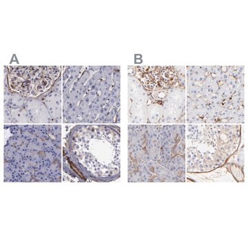 抗FLNA ウサギ宿主抗体 Ab2, Prestige Antibodies&#174; Powered by Atlas Antibodies, affinity isolated antibody, buffered aqueous glycerol solution